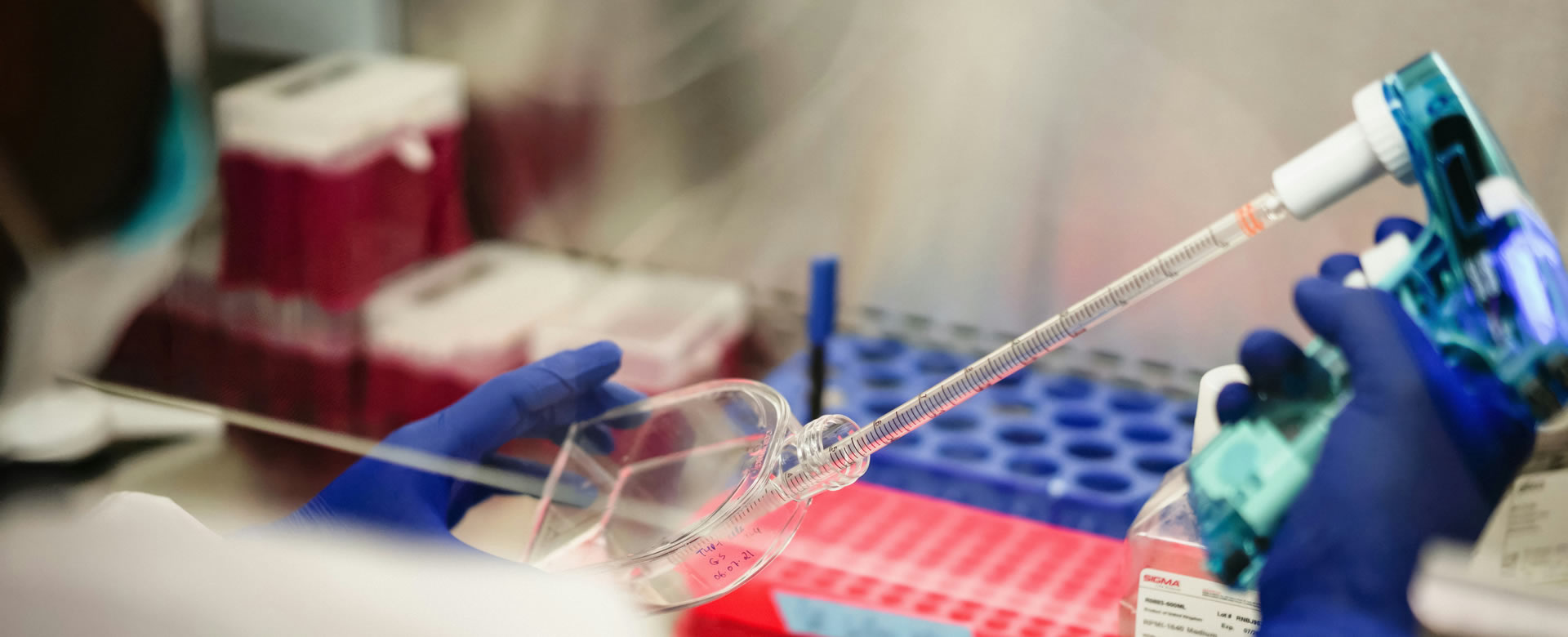 Your source for <b>Fetal Bovine Serum</b>